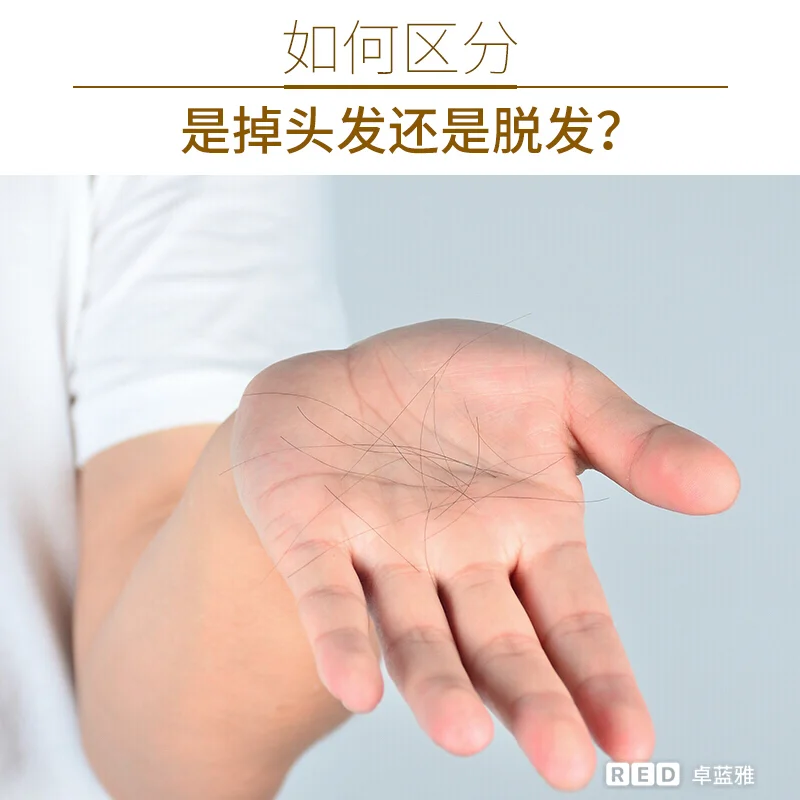 最近掉发严重怎么办_掉发特别严重该怎么办_掉发严重会是什么病