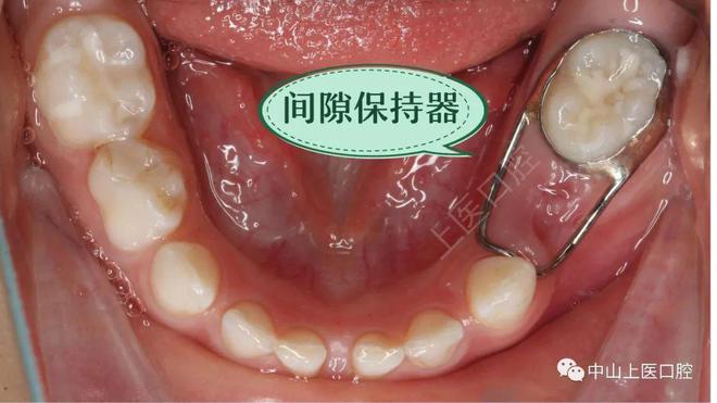 计算器算钱_计算器放钱什么意思_保持器还要单独算钱么?