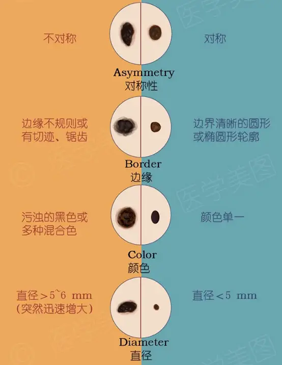 王者里面的掉点什么意思_掉点了啥意思_有哪些痣不能点掉